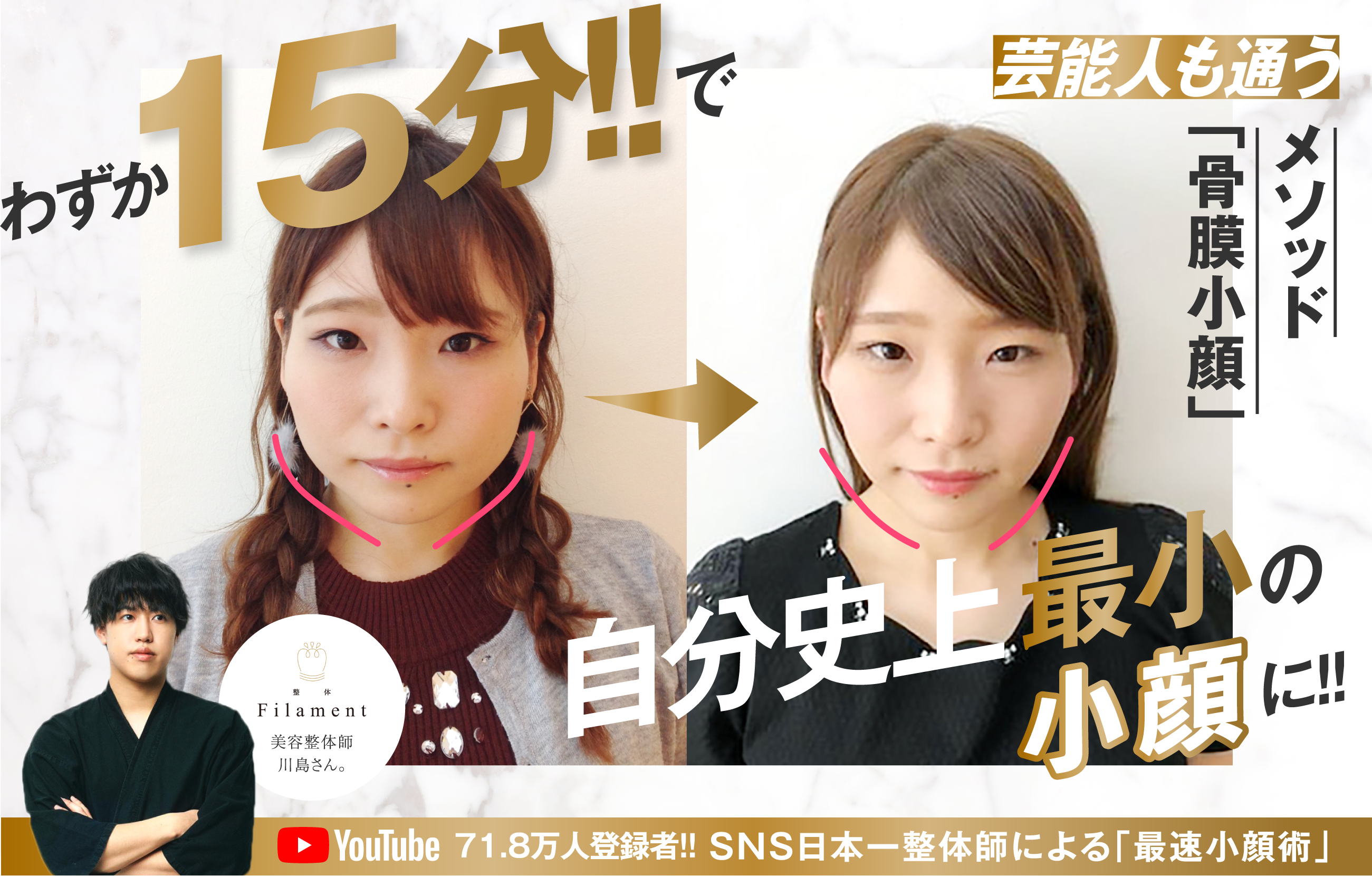 自分史上最小の小顔がわずか15分!!